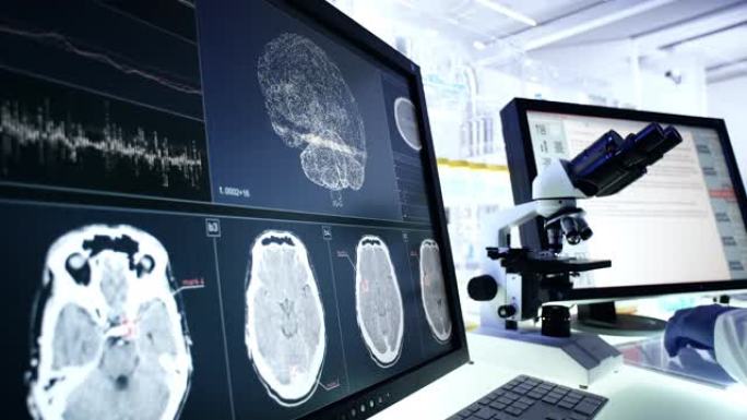 未来的实验室设备。计算机屏幕上的脑电波扫描研究