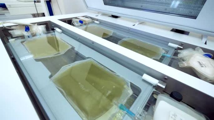 医疗设备在实验室检查装有新鲜血浆的袋子。