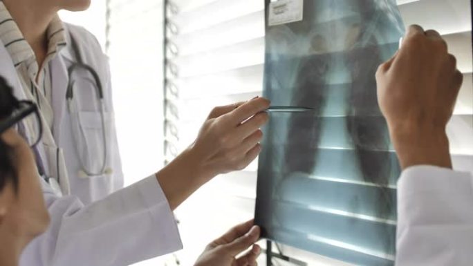 两名医生一起检查肺部x射线胶片的分析