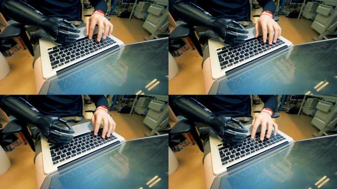 残疾人用笔记本电脑工作，特写。