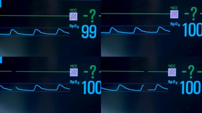 医用屏幕的脉搏计和心率指标