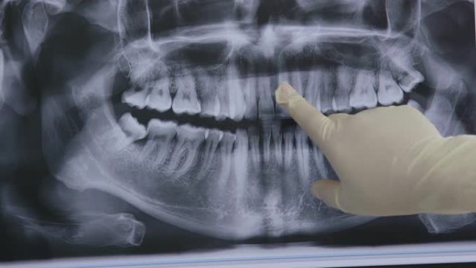 女性牙科护士分析牙齿x射线图像