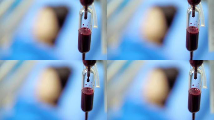 女性患者静脉滴注生理盐水溶液容积式输血泵住院