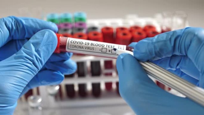 阳性冠状病毒验血概念。试管与冠状病毒阳性血液在实验室桌上。医学概念
