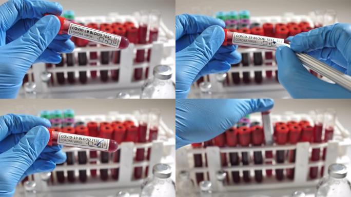 阳性冠状病毒验血概念。试管与冠状病毒阳性血液在实验室桌上。医学概念
