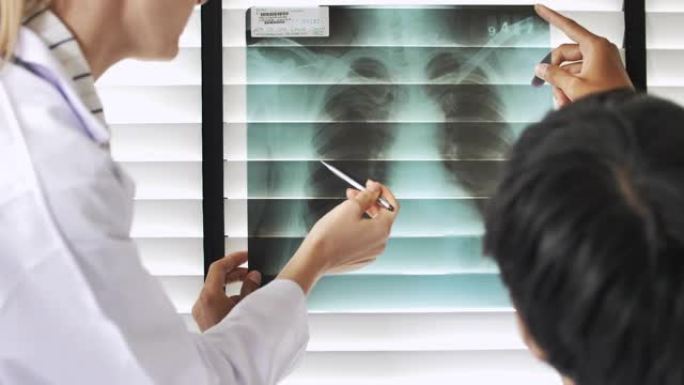 医生对肺部x射线图像胶片的分析结果