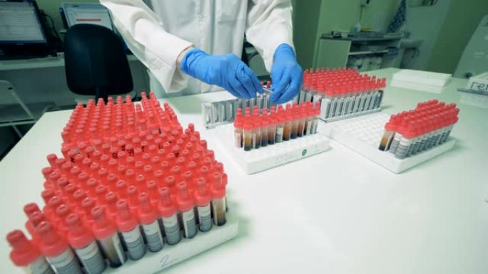 实验室工作人员进行的带有血液的试管的重新定位过程