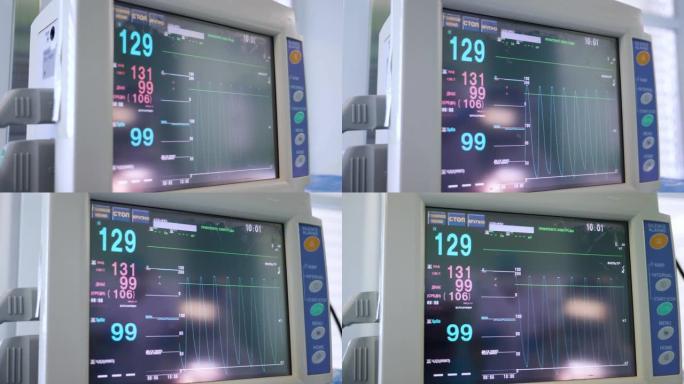 现代监视器显示手术期间患者的心率。