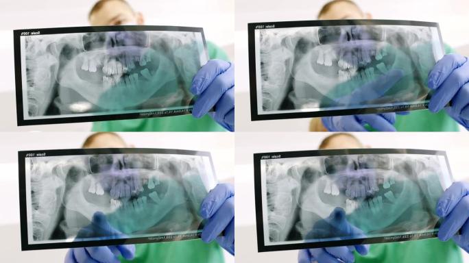 医生在牙科诊所看牙齿x射线图像