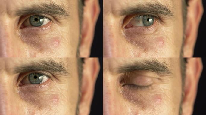 人类蓝眼睛的4k特写。慢动作。