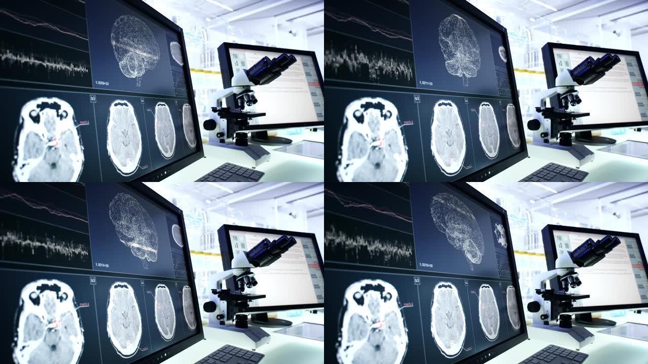 未来的实验室设备。计算机屏幕上的脑电波扫描研究