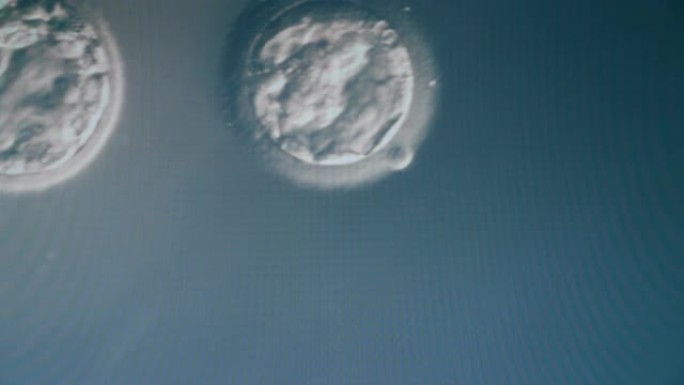 两个合子的放大运动图像