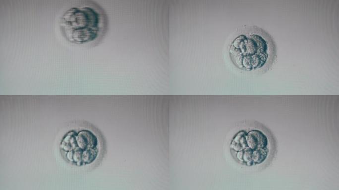 显微镜下显示的浸渍卵细胞