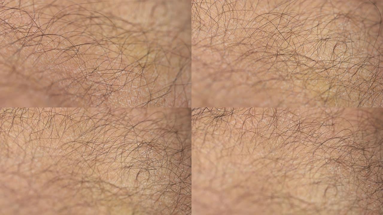 男性腿部皮肤和头发的4K CU细节