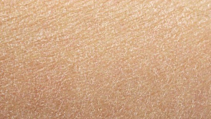 人类皮肤干燥人类皮肤干燥