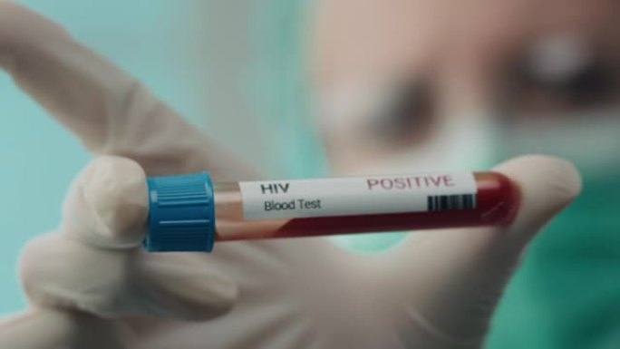 HIV阳性!血液抽血视频素材