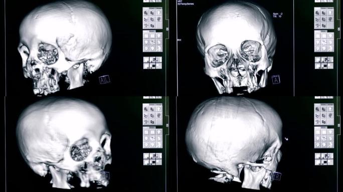 在显示器上关闭人脑的3D模型