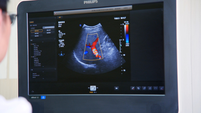 医院，医疗设备，DR，彩超，X射线，医疗