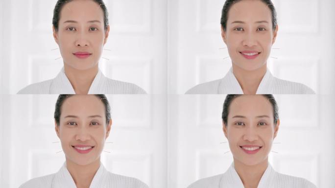 理疗师后微笑的亚洲女性患者是做针灸。医学，科学，技术，专科，教育，肖像，生活方式，替代医学概念。