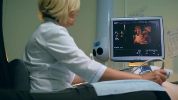 孕妇的3D超声扫描