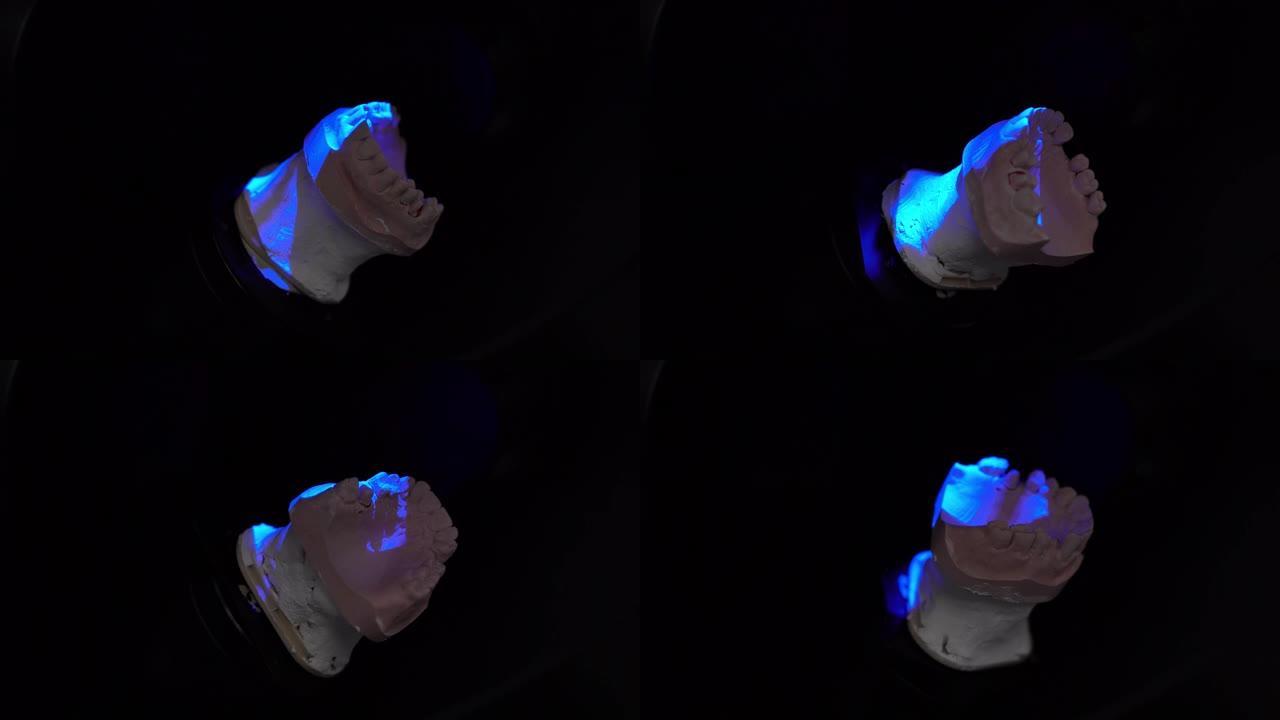 扫描机器上的陶瓷牙齿植入物