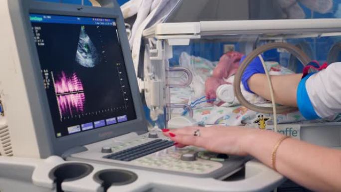 使用超声波机器检查新生儿。