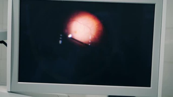 在房间里做手术时用眼睛做一个屏幕。