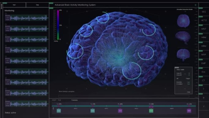 具有多个窗口和数据的大脑活动监控系统模型。具有用于计算机显示器和笔记本电脑屏幕的MRI扫描结果的医学