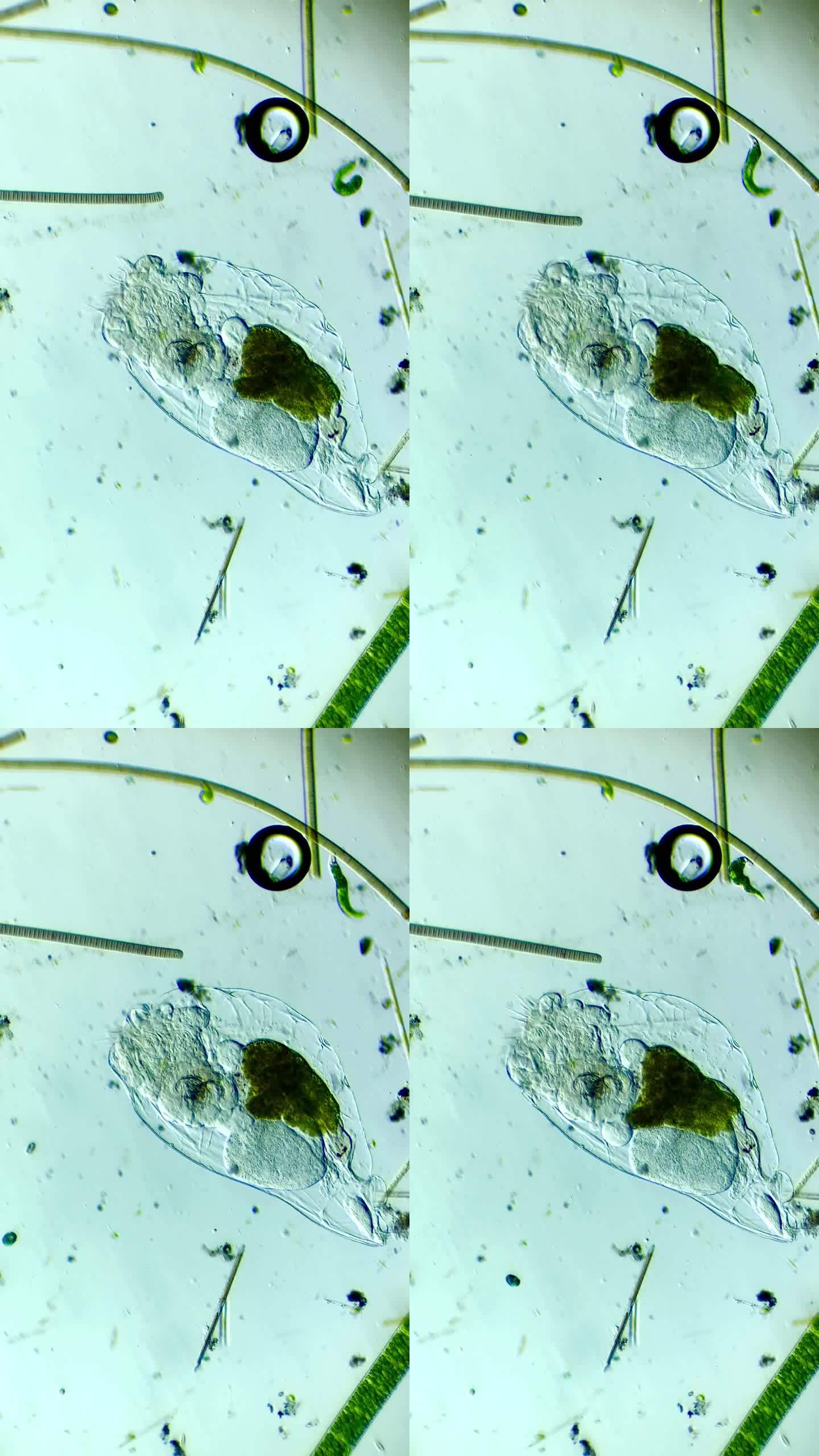 显微镜下放大100倍的轮虫