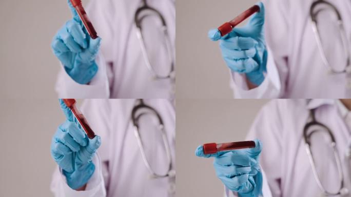 医生拿着血液试管试剂管采集抽血检查血常规