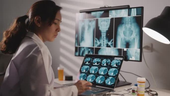 亚洲女医生在计算机上观察并分析x射线图像扫描