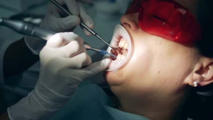 病人的牙齿正在接受医学清洗