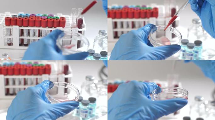 科学家在血液测试中检查冠状病毒COVID 19医学样本