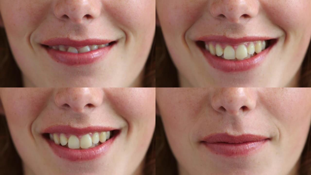 一个幸福的女人的嘴，嘴唇，牙齿和牙龈的特写镜头给人一个灿烂的微笑。一位雀斑的年轻女性感到积极，自信和