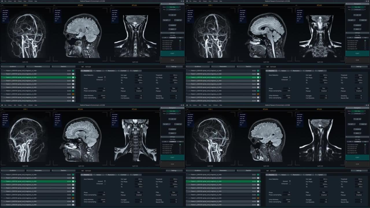具有多个窗口和数据的磁共振成像脑扫描模型。具有用于计算机显示器和笔记本电脑屏幕的MRI结果的医学研究