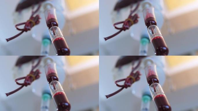 输血输血体外循环手术室