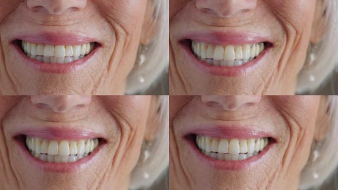一位有皱纹的资深女性的特写牙齿。一位老太太的嘴，脸上泛黄而不完美的牙齿微笑。准备去看牙医，为她的假牙