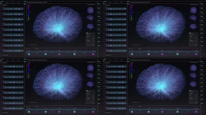 具有多个窗口和数据的大脑活动监控系统模型。具有用于计算机显示器和笔记本电脑屏幕的MRI扫描结果的医学