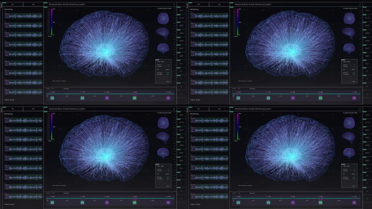 具有多个窗口和数据的大脑活动监控系统模型。具有用于计算机显示器和笔记本电脑屏幕的MRI扫描结果的医学