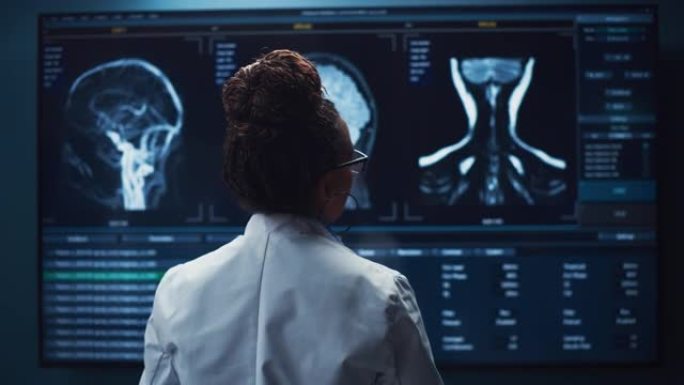 医学医院研究实验室: 黑人女性神经科学家看着电视屏幕，分析脑部扫描MRI图像，为患者寻找治疗方法。保