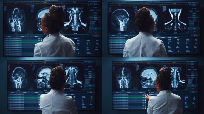 医学医院研究实验室: 黑人女性神经科学家看着电视屏幕，分析脑部扫描MRI图像，为患者寻找治疗方法。保