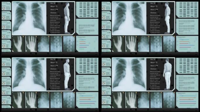 具有多个窗口和数据的计算机断层扫描胸部扫描模型。具有计算机显示器和笔记本电脑屏幕ct扫描结果的医学研
