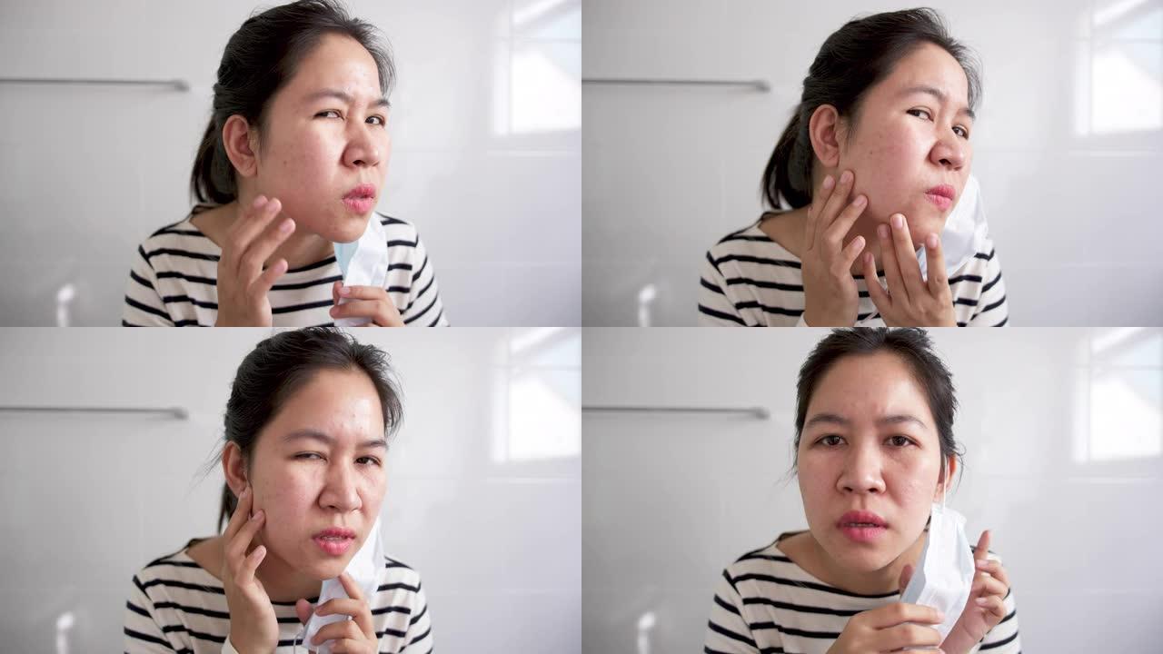年轻的亚洲女性担心戴口罩对皮肤痤疮或丘疹不满意，因为口罩显示下巴和脸颊肿胀、斑点、疤痕、皮肤过敏，新