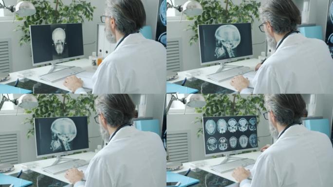 神经科医生在计算机屏幕上观察人脑MRI图像并在临床上写作