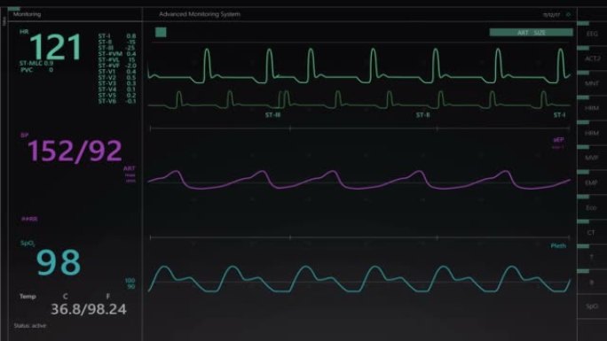 在动画模型上使用心率和其他医疗参数进行生命体征监视器。用于计算机显示器和笔记本电脑屏幕的重症监护病房