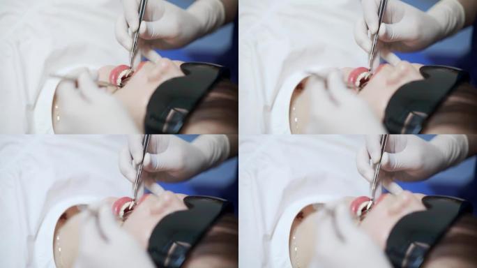 一名年轻女子在牙医办公室检查牙齿的特写