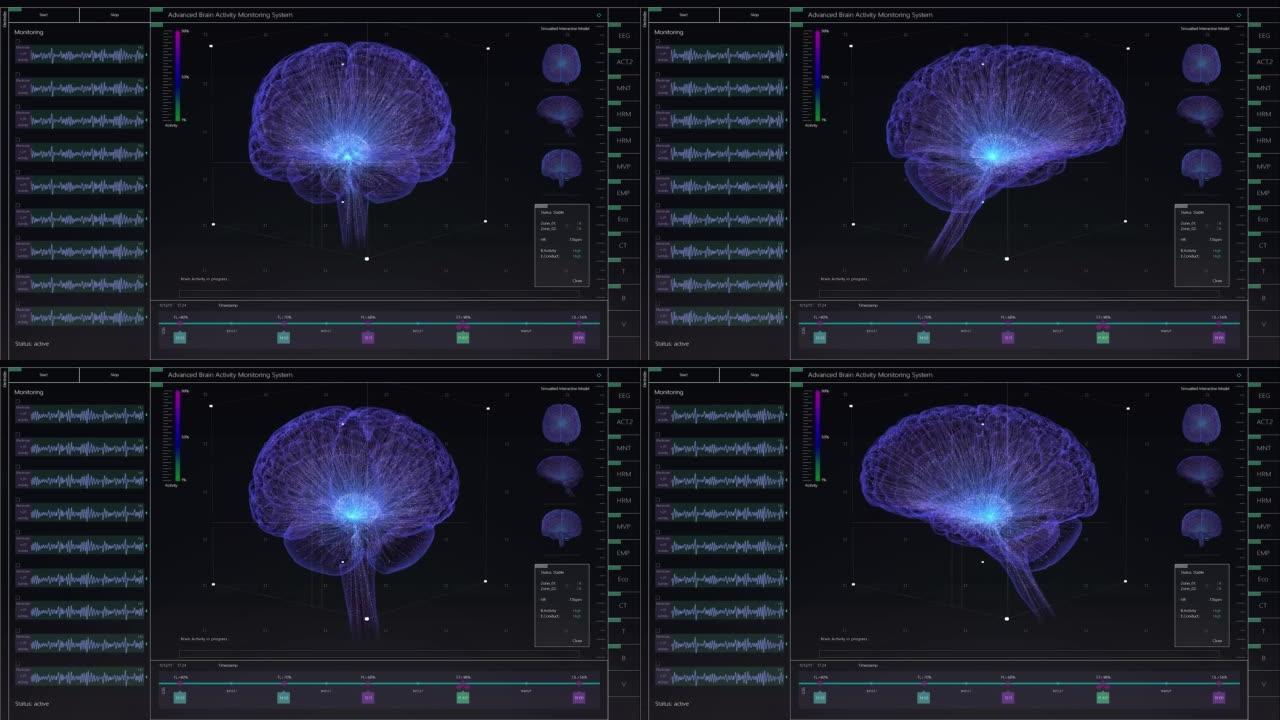具有多个窗口和数据的大脑活动监控系统模型。具有用于计算机显示器和笔记本电脑屏幕的MRI扫描结果的医学