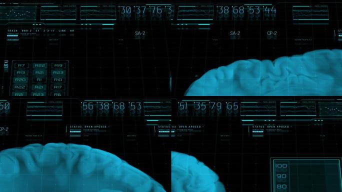 未来的医学hud界面研究和分析在物理世界中进入大脑的信息的接收，使用现代技术，MRI扫描，三维可视化