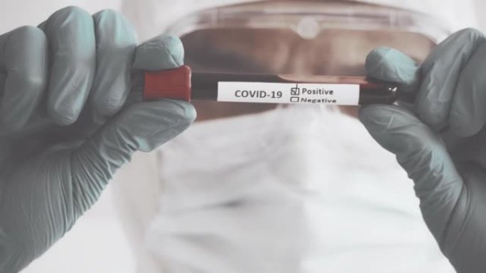 世界卫生，新型冠状病毒肺炎抗体检测