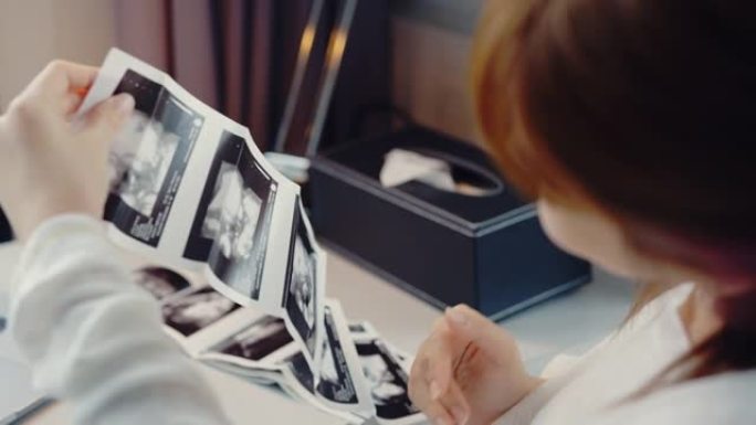 孕妇喜欢看3D超声波扫描照片。